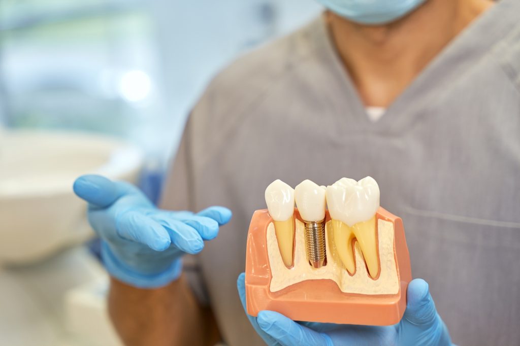 Dentist holding a dental implant model to explain tooth replacement options